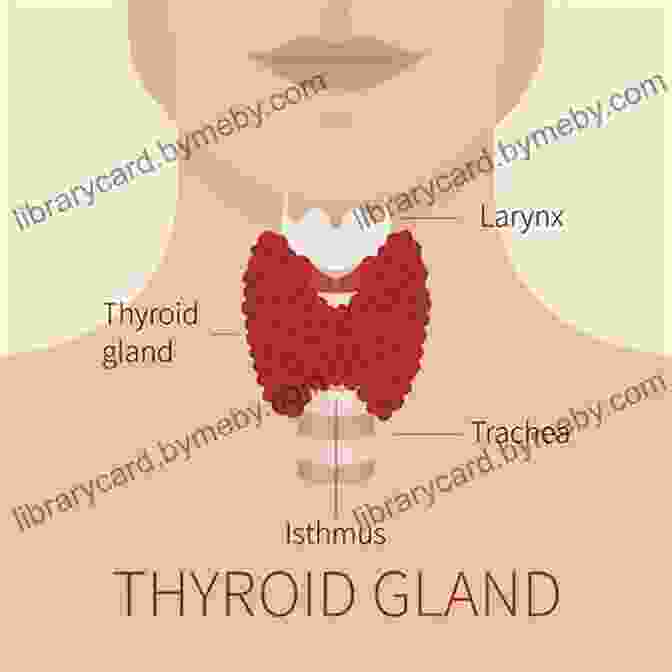 Diagram Of The Thyroid Gland Thyroid Diet : Thyroid Solution Diet Natural Treatment For Thyroid Problems Hypothyroidism Revealed